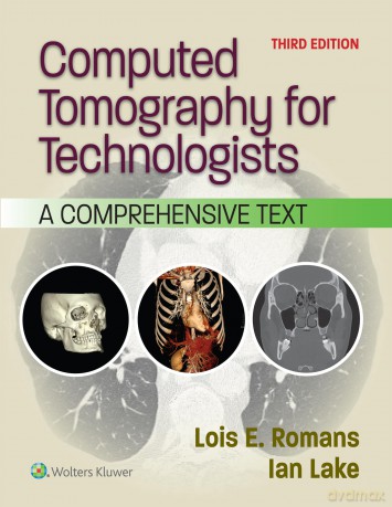 Computed Tomography for Technologists: A Comprehensive Text - LOIS E. ROMANS BA RT(R)(CT) [KSIĄŻKA]