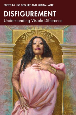 Disfigurement: Understanding Visible Difference - Lise Deguire [KSIĄŻKA]