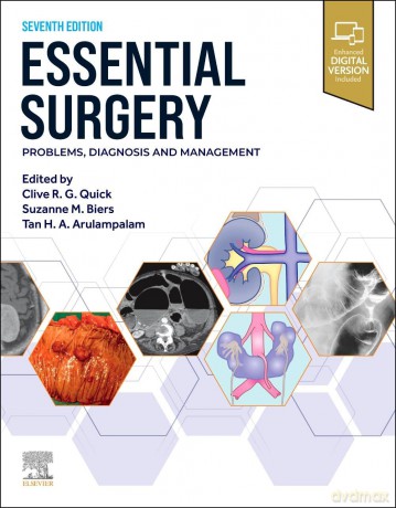 Essential Surgery: Problems, Diagnosis and Management - Clive R. G. Quick MB BS(London) FDS FRCS(England) MS(London) MA(Cambridge) [KSIĄŻKA]