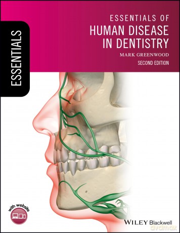 Essentials of Human Disease in Dentistry, 2nd Edition - Mark Greenwood [KSIĄŻKA]