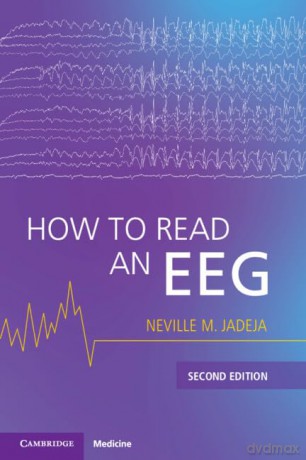 How to Read an EEG - Neville M. Jadeja [KSIĄŻKA]