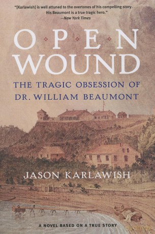 Open Wound: The Tragic Obsession Of Dr. William Beaumont - Jason Karlawish [KSIĄŻKA]