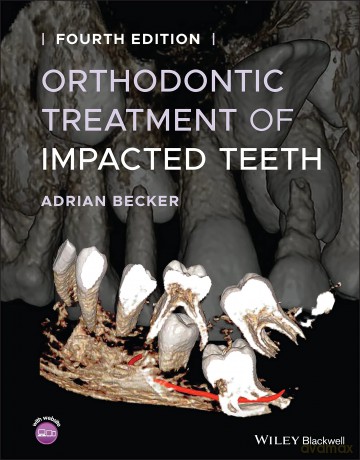 Orthodontic Treatment of Impacted Teeth - Adrian Becker [KSIĄŻKA]