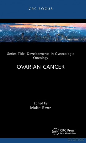 Ovarian Cancer - Malte Renz [KSIĄŻKA]