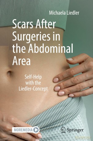 Scars After Surgeries in the Abdominal Area: Self-Help with the Liedler-Concept - Michaela Liedler [KSIĄŻKA]