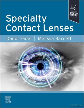 Specialty Contact Lenses - Daddi Fadel DOptom FSLS FBCLA FAAO FIACLE [KSIĄŻKA]