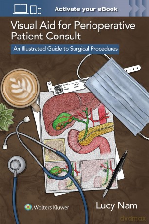 Visual Aid for Perioperative Patient Consult: An Illustrated Guide to Surgical Procedures - Lucy Nam [KSIĄŻKA]