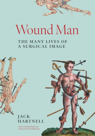 Wound Man: The Many Lives of a Surgical Image - Jack Hartnell [KSIĄŻKA]