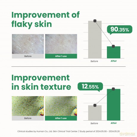 AXIS-Y - PHA Resurfacing Glow Peel - 50 ml