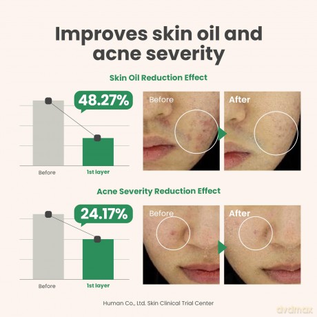 AXIS-Y - Spot the Difference Blemish Treatment - 15 ml