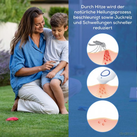 Beurer - BR 10 Insect Bite Healer - 5 Years Warranty