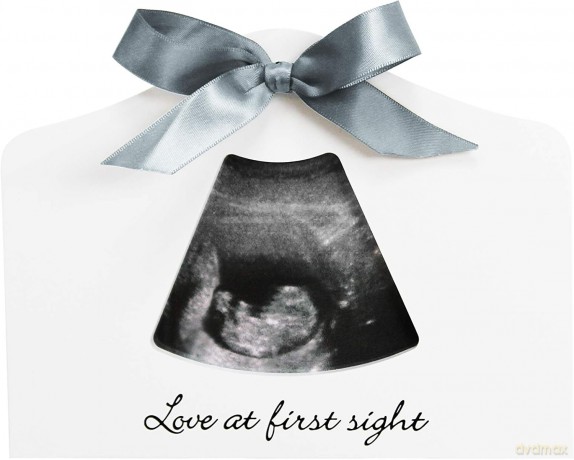 Ramka na USG ciąży Dooky - Happy Hands Sonogram Echo Frame - White - 20 x 15 cm