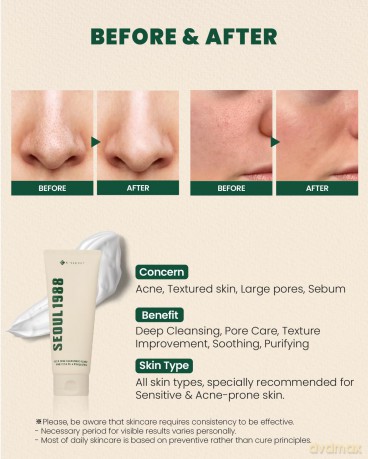KSECRET - SEOUL 1988 Cleansing Foam - Pine Cica 1% + Probiotics - 150 ml