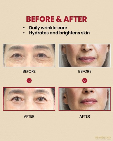 KSECRET - SEOUL 1988 Cream - Retinal Liposome 1% + Fermented Rice - 50 ml