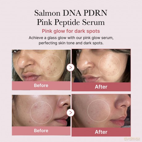 Medicube - PDRN Pink Peptide Serum - Pink - 30 ml