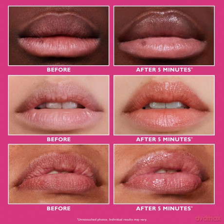 Peter Thomas Roth - Instant FIRMxÂŽ Lip Filler 10 ml