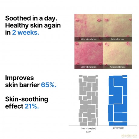 Some By Mi - Beta Panthenol Repair Serum - 30 ml