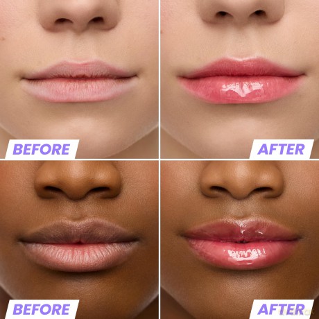 Wonderskin - Lip Rehab Serum Oil - Amour - 3.57