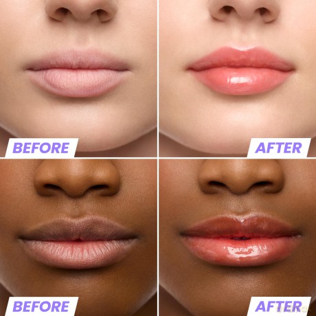 Wonderskin - Lip Rehab Serum Oil - Flirt - 3.57
