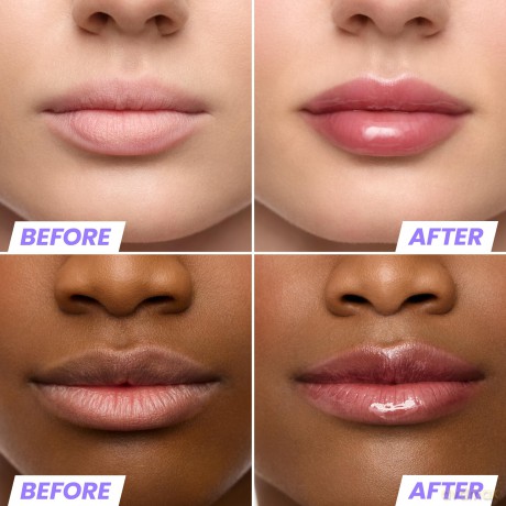 Wonderskin - Lip Rehab Serum Oil - Honey - 3.57