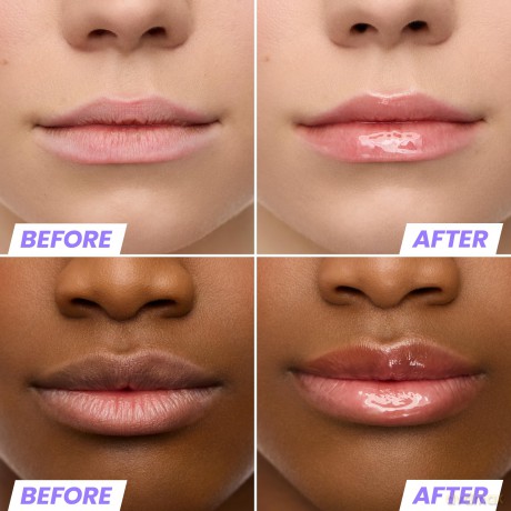 Wonderskin - Lip Rehab Serum Oil Lover - 3.57