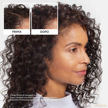 Anti-Hair Loss Shampoo (Anit-Hair Loss Shampoo) - Volume: 475 ml