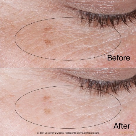 Collagen Bank Reviving Eye Gel Cream 15 ml
