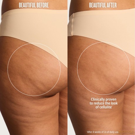 Firming and smoothing body cream (Brazilian Bum Bum Cream) - Volume: 240 ml
