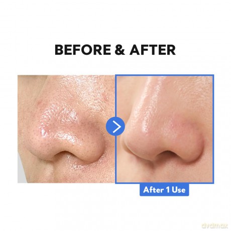Hydro Boost Enzyme Cleansing Balm (Cleansing Balm) 120 ml