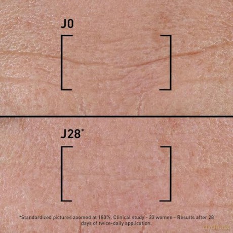 Intensive serum correcting all types of wrinkles Time Filler Intensive 5XP (All Wrinkle Types Correction Serum) 30 ml