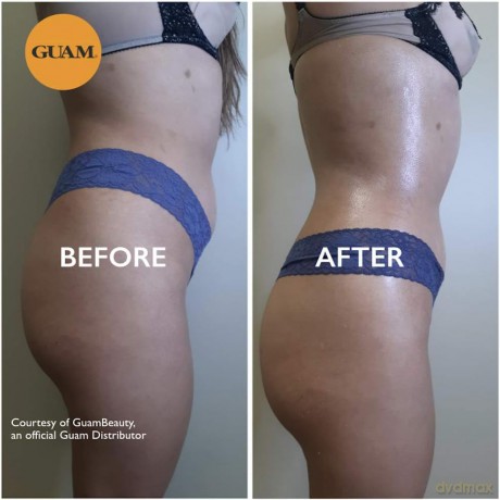 Mud pack for severe cellulite - Volume: 500 g