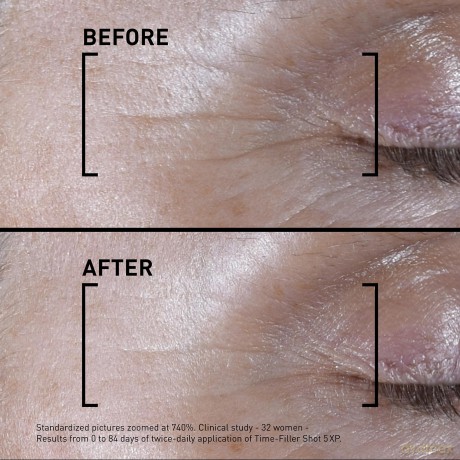 Serum against expression lines Time Filler Shot 5XP (Concentrated Serum Expression Lines) 15 ml