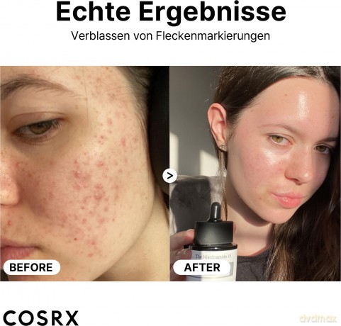 Cosrx - The Niacinamide 15 Serum - 20 ml [KOMSETYKI]