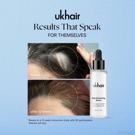 UKLASH- Ukhair Hair Growth Serum - 50ml