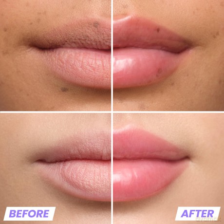 Wonderskin - Lip Relapse Plumping Gloss - 3.57