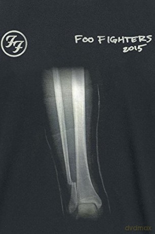 Foo Fighters: X-RAY 2015