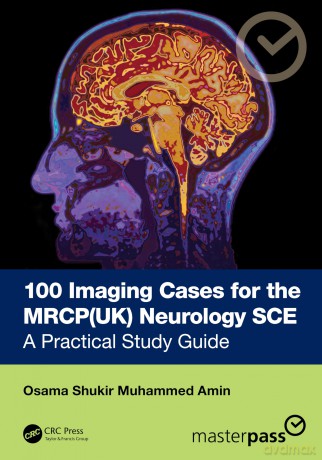 100 Imaging Cases for the MRCP Specialty Certificate Examination in Neurology: A Practical Study Guide (MasterPass) - Dr Osama Shukir Muhammed Amin [KSIĄŻKA]