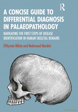 A Concise Guide to Differential Diagnosis in Palaeopathology: Navigating the First Steps of Disease Identification in Human Skeletal Remains - Efthymia Nikita [KSIĄŻKA]