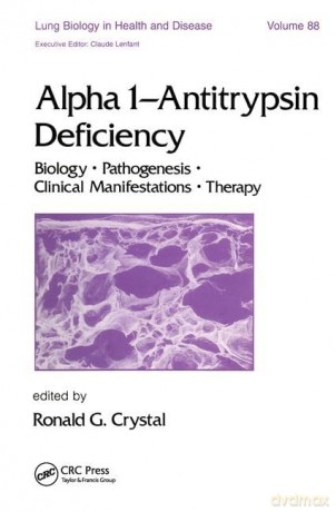 Alpha 1 - Antitrypsin Deficiency: Biology-Pathogenesis-Clinical Manifestations-Therapy: 88 (Lung Biology in Health and Disease) - Ronald G. Crystal [KSIĄŻKA]