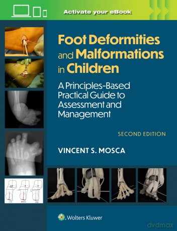 Foot Deformities and Malformations in Children: A Principles-Based, Practical Guide to Assessment and Management: Print + eBook with Multimedia - Vincent Mosca [KSIĄŻKA]