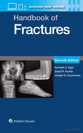 Handbook of Fractures: Print + eBook with Multimedia - Kenneth A. Egol Md [KSIĄŻKA]