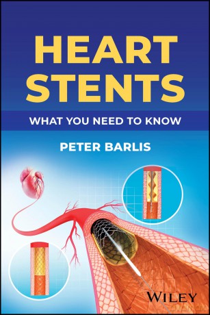 Heart Stents: What You Need to Know - Peter Barlis [KSIĄŻKA]