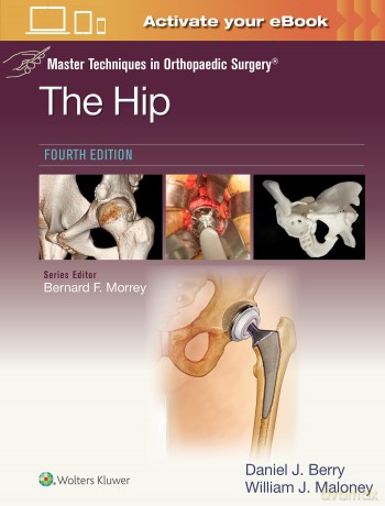 Master Techniques in Orthopaedic Surgery: The Hip: Print + eBook with Multimedia - Daniel John Berry [KSIĄŻKA]