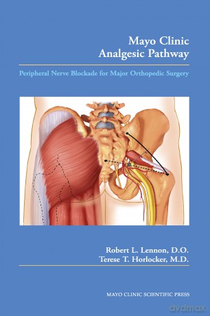 Mayo Clinic Analgesic Pathway: Peripheral Nerve Blockade for Major Orthopedic Surgery - Robert L. Lennon [KSIĄŻKA]