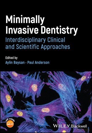 Minimally Invasive Dentistry: Interdisciplinary Clinical and Scientific Approaches - Aylin Baysan [KSIĄŻKA]