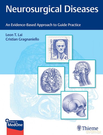 Neurosurgical Diseases: An Evidence-Based Approach to Guide Practice - Leon Tat Lai [KSIĄŻKA]