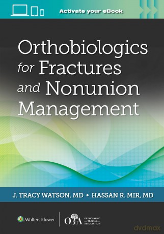 Orthobiologics for Fractures and Nonunion Management - Dr. J Tracy Watson MD [KSIĄŻKA]
