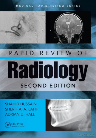 Rapid Review of Radiology (Medical Rapid Review Series) - Shahid Hussain [KSIĄŻKA]