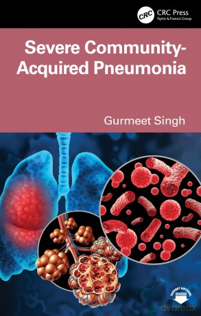 Severe Community-Acquired Pneumonia - Gurmeet Singh [KSIĄŻKA]