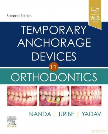 Temporary Anchorage Devices in Orthodontics - Ravindra Nanda BDS MDS PhD [KSIĄŻKA]
